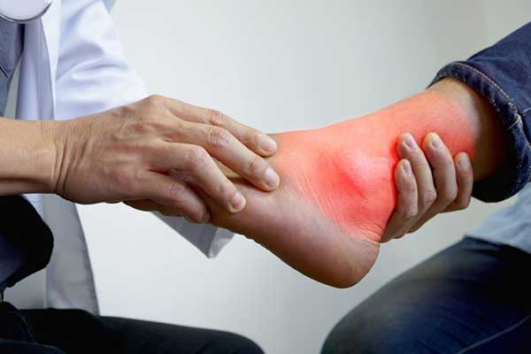 Crystal-Induced Arthropathies Treatment by Dr. Juhi Dixit
